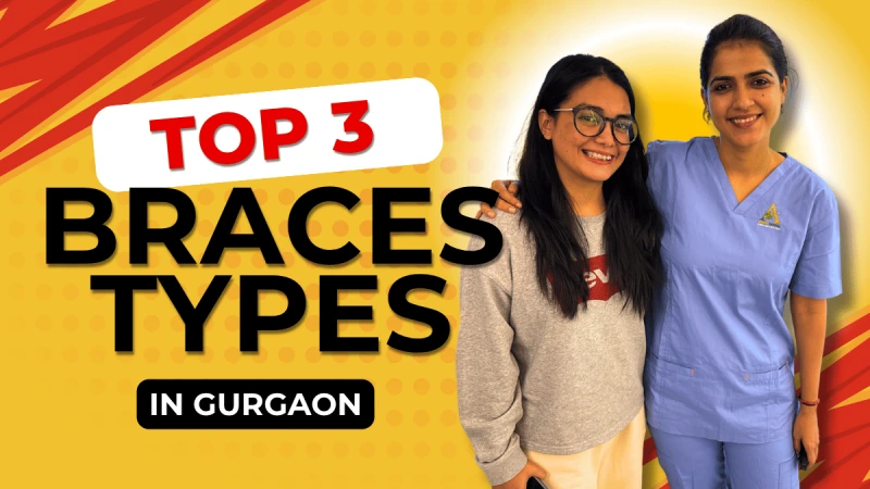 Types of Braces in Gurgaon: Metal, Ceramic & Invisalign