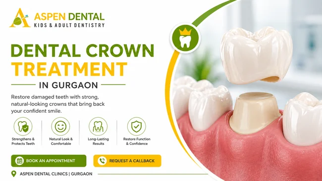 Dental Crown Treatment in Gurgaon at Aspen Dentals