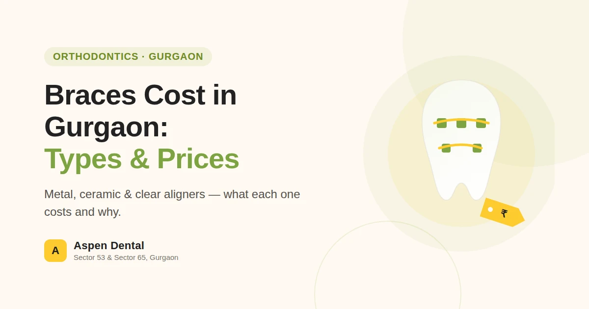 Braces cost guide for Aspen Dentals patients in Gurgaon