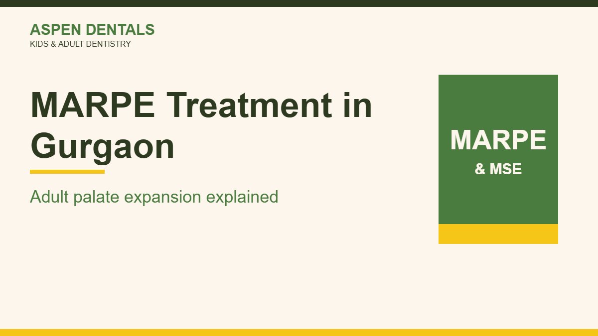 MARPE treatment in Gurgaon adult palate expansion guide