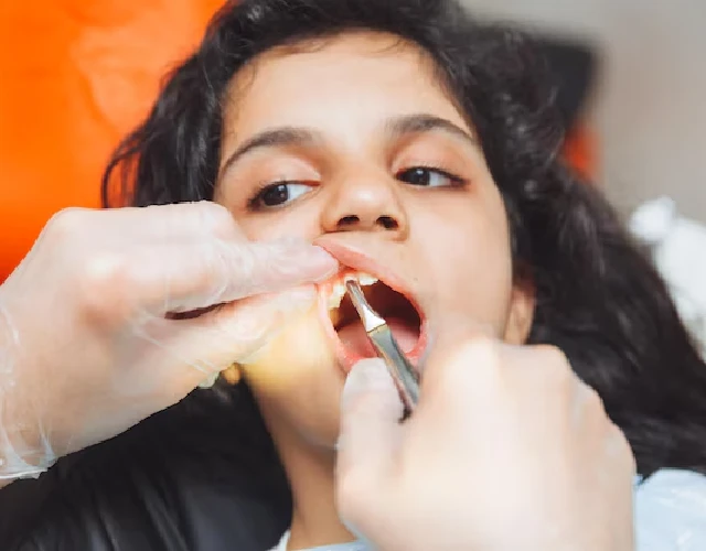 Pediatric Tooth Extraction