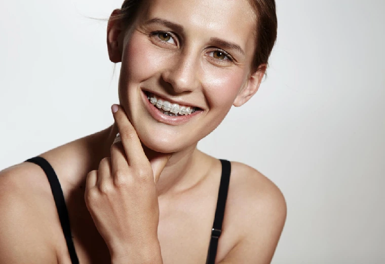 Ceramic Braces in Gurgaon – A Discreet Way to Straighten Your Smile