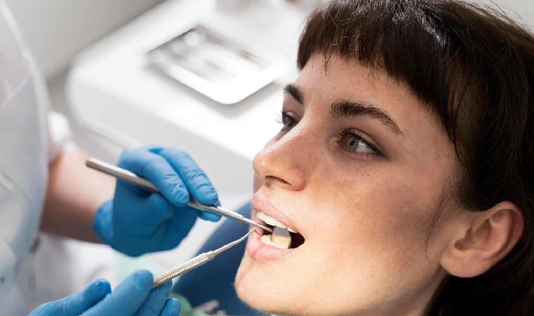 Dental Fillings in Gurgaon