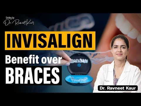 Invisalign vs Braces: Which One is Right for You? Orthodontist in Gurgaon