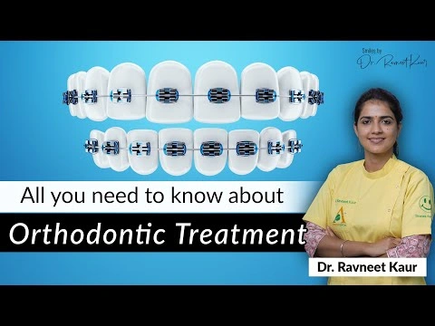 Everything you need to Know about Orthodontic Treatment and Braces | Orthodontic doctor in Gurugram