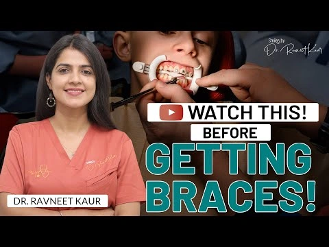 Things to Know Before Getting Braces | Are Braces Painful? | Dr. Ravneet Kaur