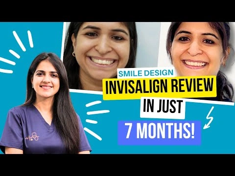 Invisalign Reviews: Yashti's Smile Transformation in 7 Months | Best Invisalign Dentist in Gurgaon.